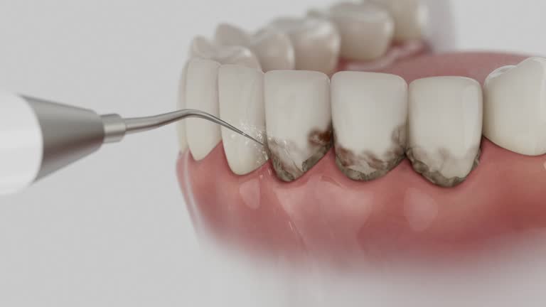 Reliable Root Canal Treatment contractor in Pike County County, KY by Dentist Open Now